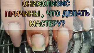 Онихолизис😱Как поступить мастеру? Причины онихолизиса. Коррекция ногтей гелем.