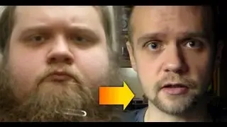 My Weight Loss Journey: 165 Lb. Body Transformation Story