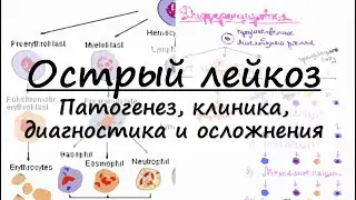 Острый лейкоз : патогенез, клинические проявления, гемограмма