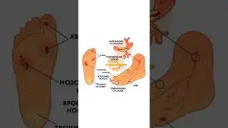 Диабетическая стопа #альсария #диабет #сахар #сосуды