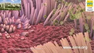 Health Effects of Smoking (Hindi) - CIMS Hospital