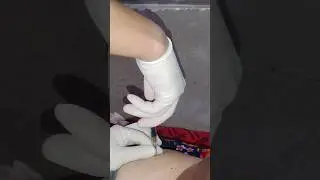 #укол #уколы #внутримышечно внутримышечная инъекция