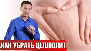 Никак не можете избавиться от целлюлита? 📣 И вот почему...