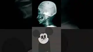 공포의 딱밤