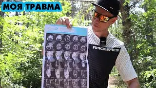 НЕПРАВИЛЬНЫЙ ДИАГНОЗ, ЧТО НА САМОМ ДЕЛЕ БЫЛО С МОЕЙ НОГОЙ И КТО ВИНОВАТ