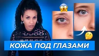 Как убрать тёмные круги и отёки под глазами? // Эффект панды🐼: простой рецепт для осветления кожи