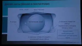 Преимущества факичной коррекции аметропий