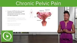 Chronic Pelvic Pain (CPP): Definition, Diagnosis & Management – Gynecology | Lecturio