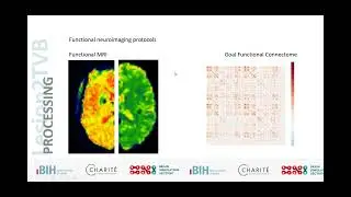 Processing of Stroke Patients for the Virtual Brain - Patrik Bey
