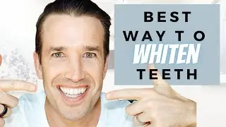 Best Teeth Whitening | How to Whiten Your Teeth