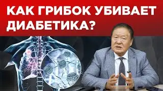 Грибок у диабетика / Как лечить? / Чем опасен?