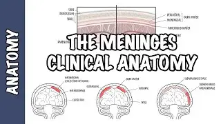 Clinical Anatomy - Meninges (Intracranial hematoma, subdural, epidural, subarachnoid and meningitis)