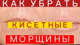 Маска от КИСЕТНЫХ Морщин вокруг РТА Легко и Быстро!Эффект Сразу!!!helen marynina