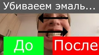 Отбеливание зубов / Зубная паста President / Проверяю пасту / Индекс / PDI / PDI 200 /