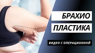 БРАХИОПЛАСТИКА | КАК УБРАТЬ ОБВИСШУЮ КОЖУ РУК? | ПОДТЯЖКА ПЛЕЧ | ПЛАСТИКА РУК КИЕВ | ПОДТЯЖКА РУК