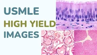 USMLE High Yield Images