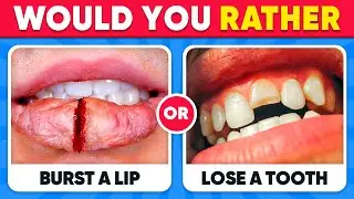 Would You Rather...? 100 HARDEST Choices Ever! 😱⚠️ EXTREME Edtion