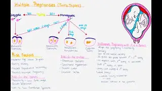 Multiple Pregnancy (Twins, Triplets) - Zygosity, Chorionisity, Amnionisity, Risks, Delivery