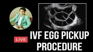 🔴[LIVE]  Egg Retrieval Procedure | ivf | icsi |  Ovum Pickup | Malayalam video | step by step| cost