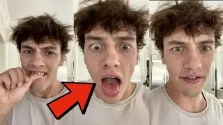 How to make your tongue bleed!! 😳👅 - 