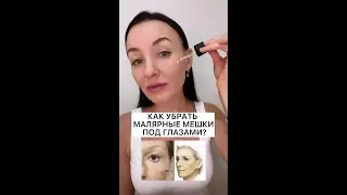 Как убрать мешки под глазами#shots