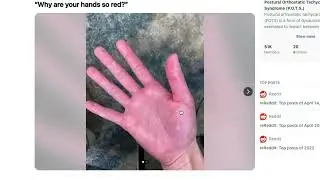 Why do our hands turn so red sometimes?