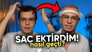 SAÇ EKTİRME ACILI MI? - İlk Haftam Nasıl Geçti?