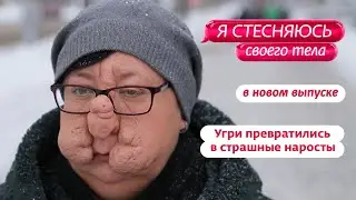Я стесняюсь своего тела. Россия | Новый выпуск 13 апреля