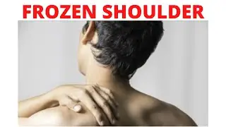 Frozen Shoulder