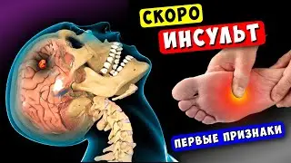 8 Признаков скорого ИНСУЛЬТА! Тело предупреждает, НЕ Пропусти - ВЫЖИВЕШЬ