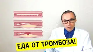 Еда и Лекарства против ТРОМБОЗА