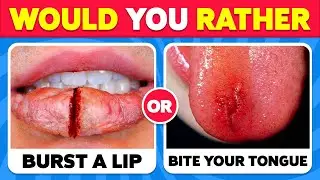 Would You Rather...? 100 HARDEST Choices Ever! 😱😨