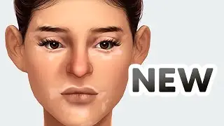 Vitiligo Skin Detail in The Sims Update! SDX Feb 2024