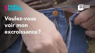 Voulez-vous voir mon excroissance? | Dr Pimple Popper