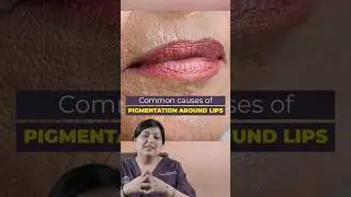 होंठो के आस पास के कालेपन को कैसे दूर करे? | Pigmentation around mouth | Best dermatologist in Delhi