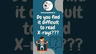 #shorts "Let's hack an X-Ray" for curious Medical students