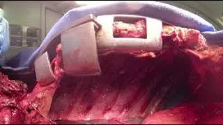 VR Anatomy - inside the thorax (chest cavity) of a cadaver in 360°