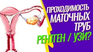 ГИСТЕРОСАЛЬПИНГОГРАФИЯ (ГСГ маточных труб) 🚩 Проверить проходимость труб