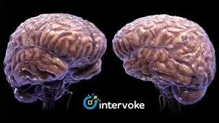 The Human Brain Medical Animation by Intervoke