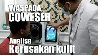 KONSULTASI KESEHATAN WAJAHKU DI YBE BRIGHT NGALIYAN