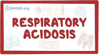 Respiratory acidosis - causes, symptoms, diagnosis, treatment, pathology