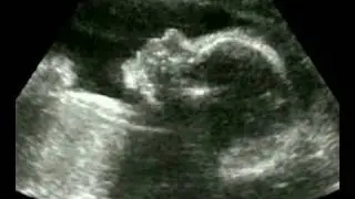Fotos 1 - da barriga ao 1º mês.