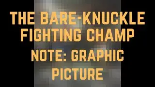 Gawsr - The Bare-Knuckle Fighting Champ