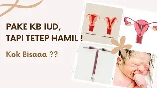 PAKE KB IUD TAPI TETEP HAMIL, KOK BISA ? | Bidan Merina