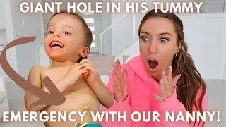 OUR DISABLED SON PULLS HIS G-TUBE OUT WITH OUR NANNY! MEDICAL EMERGENCY!