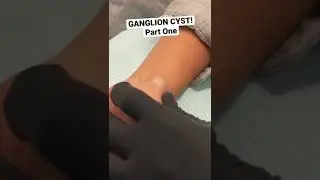 SHORT: GANGLION CYST!