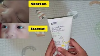 Setelah Satu Bulan Pemakaian Expert Care Daily Proatect Shooting & Calming Cream