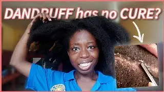 GET RID OF ITCHY SCALP (dandruff, headlice and dry scalp)