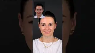 ОТОПЛАСТИКА ДО И ПОСЛЕ