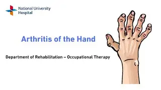 Arthritis of the Hand